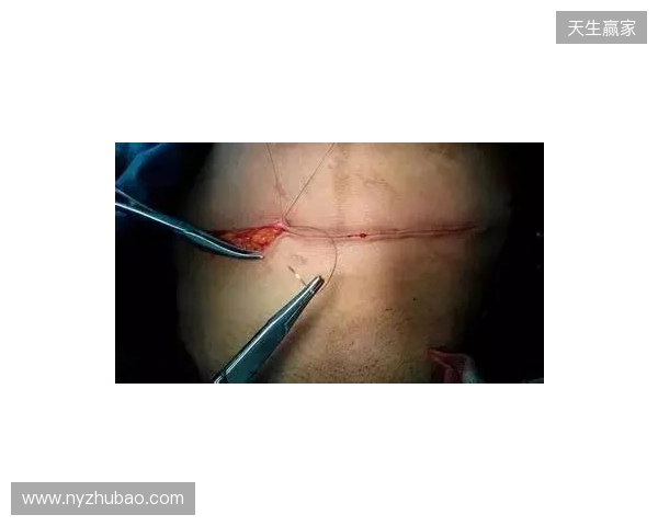 广州豹官方:杨浩眉弓伤口缝合30余针,预计5-7天后拆线